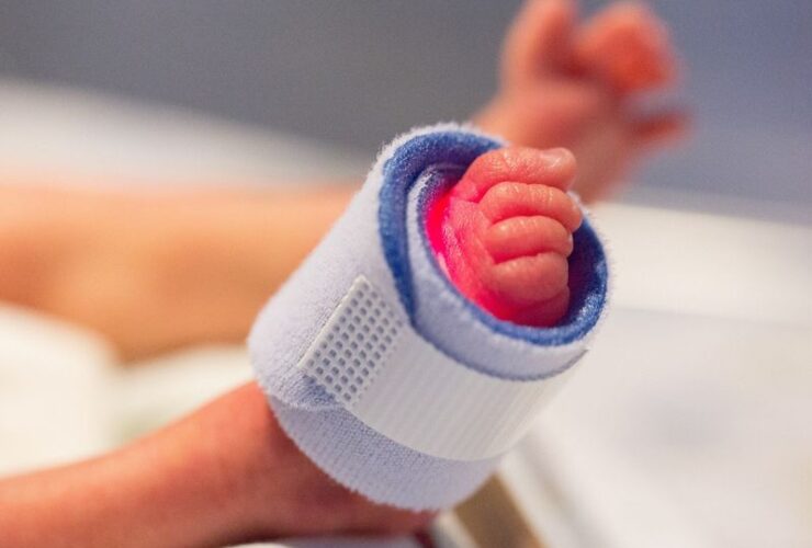 La preocupante realidad de los partos prematuros: 1 de cada 10 nacimientos en el mundo partos prematuros