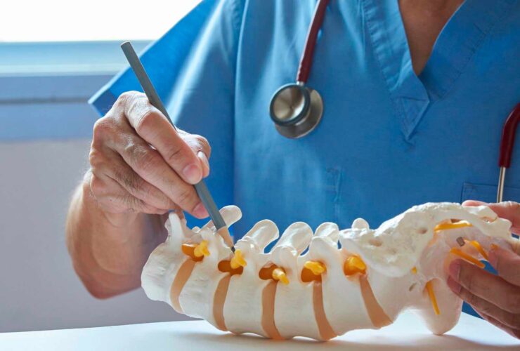 Cuándo derivar un dolor lumbar al especialista de columna: banderas rojas para el fisioterapeuta cirugia columna